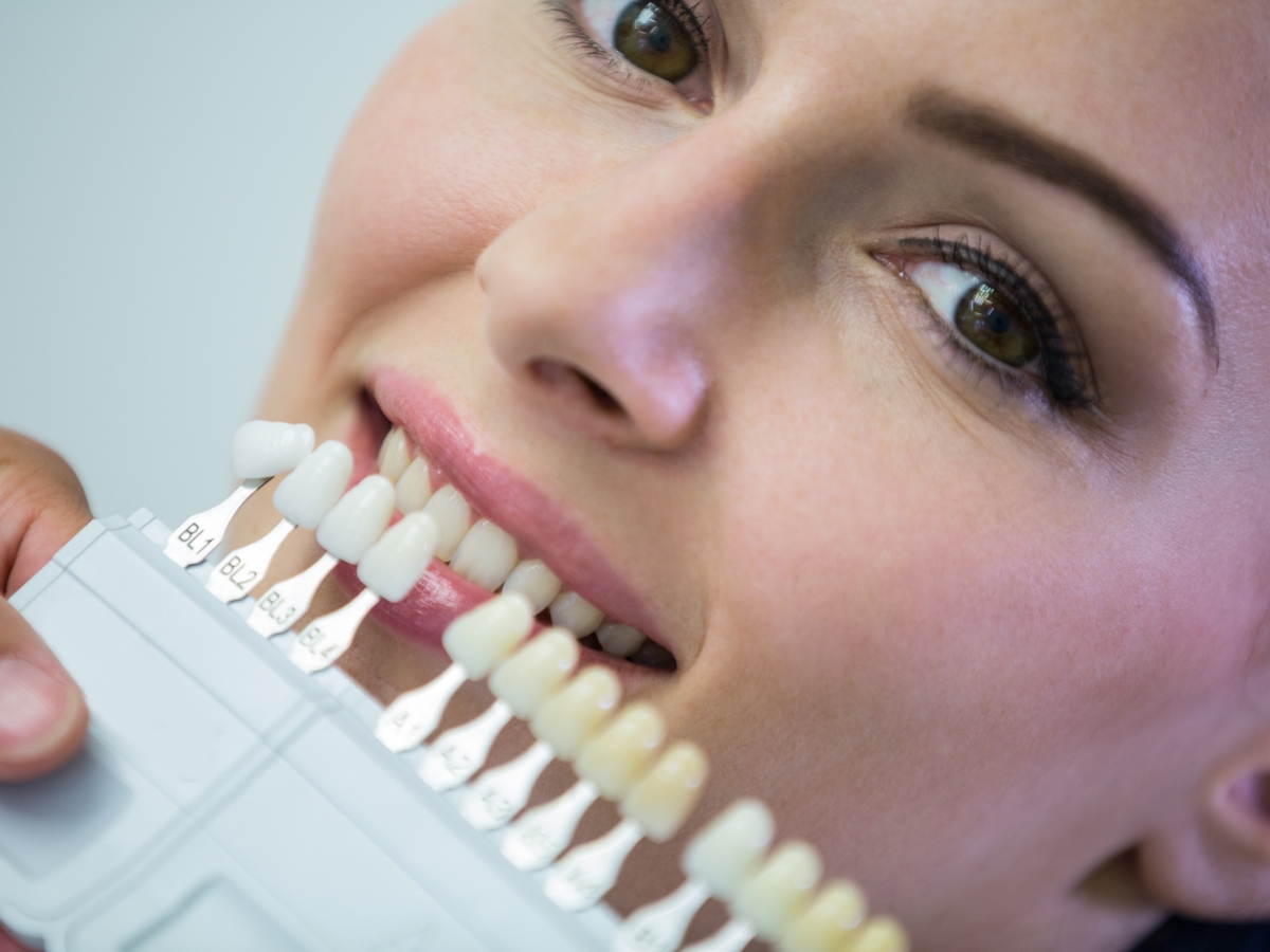 Facetas e Clareamento Dental em Balneário Camboriú: Estética com Segurança